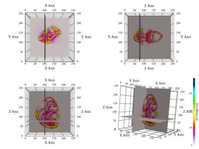 Baseline: sphx_glr_slice_orthogonal_002_vtksz
