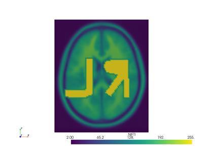Baseline: pyvista-examples-downloads-download_brain_atlas_with_sides-7b7ce4aa5c1a33f6_00_00