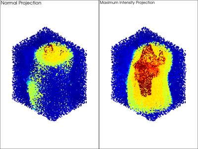 Baseline: sphx_glr_maximum_intensity_projection_001