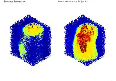 Baseline: sphx_glr_maximum_intensity_projection_thumb