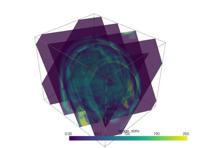 Baseline: sphx_glr_slice_007