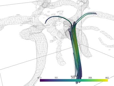 Baseline: sphx_glr_streamlines_001