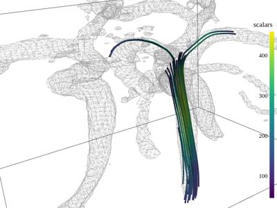 Baseline: sphx_glr_streamlines_001_vtksz