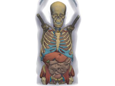 Generated: pyvista-examples-downloads-download_whole_body_ct_male-9511ada8603c5140_00_00