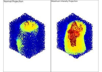 Generated: sphx_glr_maximum_intensity_projection_thumb